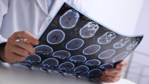 brain scan