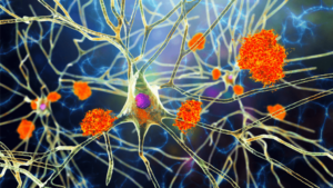 compensation for nerve damage