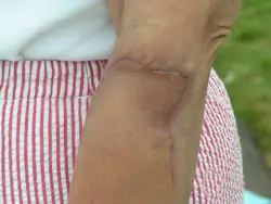 Michigan dog bite case results
